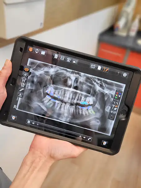 Foto eines Tablets das ein Röntgenbild mit KI erzeugter Annotation darstellt